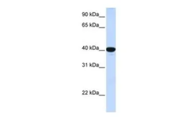 Anti-G6PC antibody, N-term used in Western Blot (WB). GTX46748