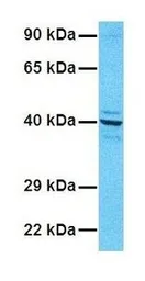 Anti-G6PC antibody, N-term used in Western Blot (WB). GTX46748