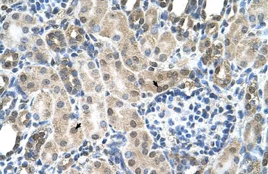 Anti-SLC19A1 antibody, N-term used in IHC (Paraffin sections) (IHC-P). GTX46753