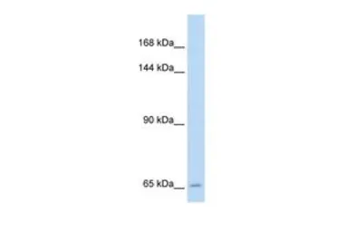 Anti-SLC19A1 antibody, N-term used in Western Blot (WB). GTX46753