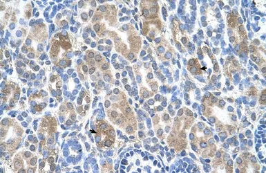 Anti-SLC36A3 antibody, N-term used in IHC (Paraffin sections) (IHC-P). GTX46758