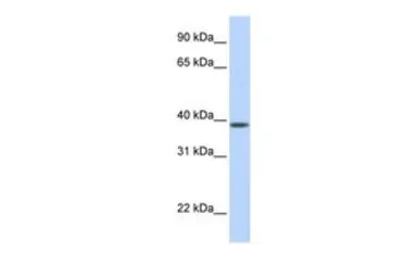Anti-SLC25A42 antibody, N-term used in Western Blot (WB). GTX46759
