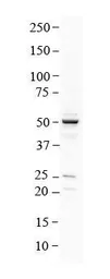 Anti-SLC41A1 antibody, N-term used in Western Blot (WB). GTX46760