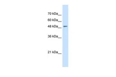 Anti-SLC43A2 antibody, N-term used in Western Blot (WB). GTX46770