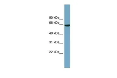 Anti-SLC5A8 antibody, Internal used in Western Blot (WB). GTX46771