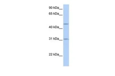 Anti-SLC39A11 antibody, Internal used in Western Blot (WB). GTX46777