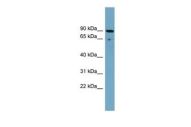 Anti-SLC26A9 antibody, Internal used in Western Blot (WB). GTX46782