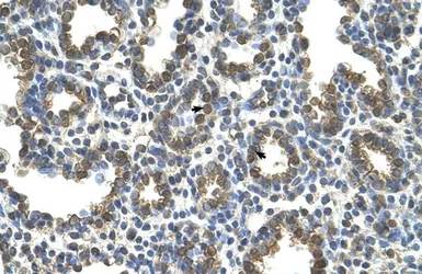 Anti-SLC37A3 antibody, Internal used in IHC (Paraffin sections) (IHC-P). GTX46786