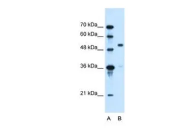 Anti-SLC37A3 antibody, Internal used in Western Blot (WB). GTX46786