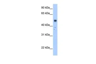 Anti-SLC35F5 antibody, C-term used in Western Blot (WB). GTX46791