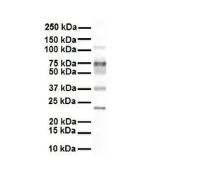 Anti-SLC27A3 antibody, Internal used in Western Blot (WB). GTX46793