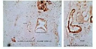 Anti-SLC39A8 antibody, N-term used in IHC (Paraffin sections) (IHC-P). GTX46794