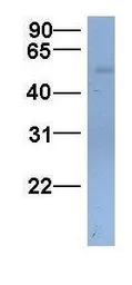 Anti-SLC22A11 antibody, C-term used in Western Blot (WB). GTX46805