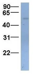 Anti-SLC22A11 antibody, C-term used in Western Blot (WB). GTX46805