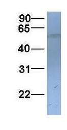 Anti-SLC22A11 antibody, C-term used in Western Blot (WB). GTX46805