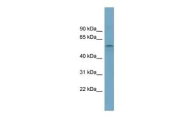 Anti-SLC22A15 antibody, Internal used in Western Blot (WB). GTX46807