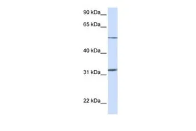 Anti-SLC35A5 antibody, N-term used in Western Blot (WB). GTX46810