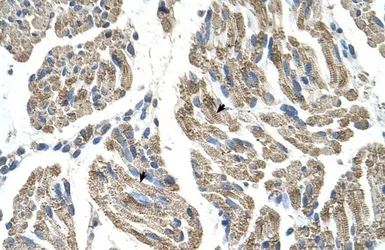 Anti-SLC25A38 antibody, Internal used in IHC (Paraffin sections) (IHC-P). GTX46811