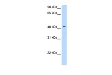 Anti-SLC25A24 antibody, Internal used in Western Blot (WB). GTX46817