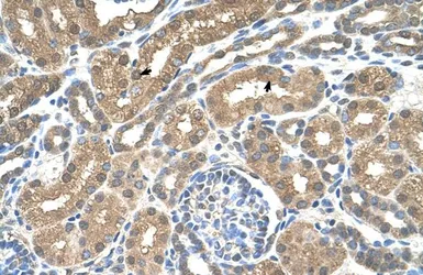 Anti-MCT3 antibody, Internal used in IHC (Paraffin sections) (IHC-P). GTX46818