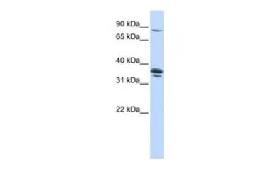Anti-SLCO3A1 antibody, Internal used in Western Blot (WB). GTX46819