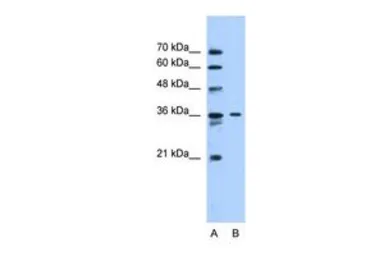 Anti-SLC35A3 antibody, Internal used in Western Blot (WB). GTX46820