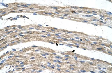 Anti-SLC17A4 antibody, Internal used in IHC (Paraffin sections) (IHC-P). GTX46824