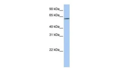 Anti-SLC22A14 antibody, N-term used in Western Blot (WB). GTX46827