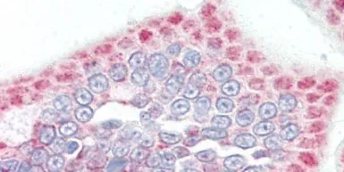 Anti-SLC33A1 antibody, Internal used in IHC (Paraffin sections) (IHC-P). GTX46828