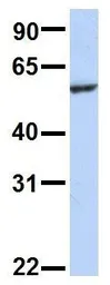 Anti-SLC33A1 antibody, Internal used in Western Blot (WB). GTX46828