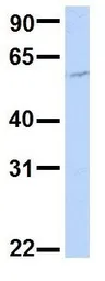 Anti-SLC33A1 antibody, Internal used in Western Blot (WB). GTX46828