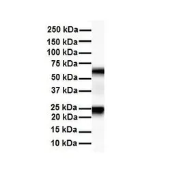 Anti-SLC33A1 antibody, Internal used in Western Blot (WB). GTX46828