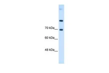 Anti-SLC7A4 antibody, Internal used in Western Blot (WB). GTX46833