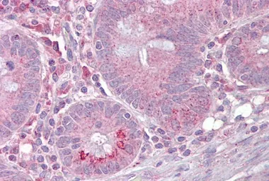 Anti-SLC13A2 antibody, Internal used in IHC (Paraffin sections) (IHC-P). GTX46836