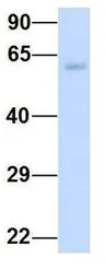 Anti-SLC7A7 antibody, Internal used in Western Blot (WB). GTX46837