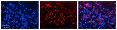 Anti-Adenine Nucleotide Translocase 1 antibody, N-term used in IHC (Paraffin sections) (IHC-P). GTX46847