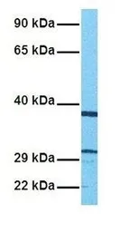 Anti-Adenine Nucleotide Translocase 1 antibody, N-term used in Western Blot (WB). GTX46847