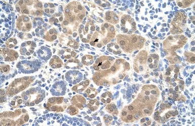 Anti-SLC38A1 antibody, Internal used in IHC (Paraffin sections) (IHC-P). GTX46849