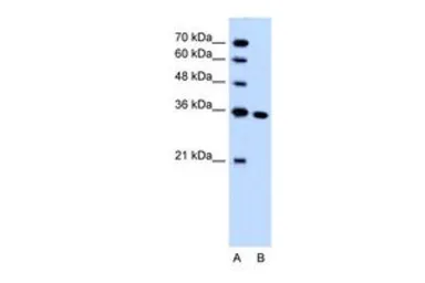 Anti-SLC25A29 antibody, C-term used in Western Blot (WB). GTX46852