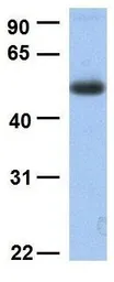 Anti-SLC45A2 antibody, C-term used in Western Blot (WB). GTX46854
