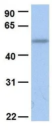 Anti-SLC45A2 antibody, C-term used in Western Blot (WB). GTX46854