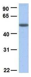 Anti-SLC45A2 antibody, C-term used in Western Blot (WB). GTX46854