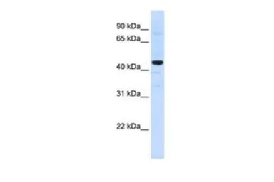 Anti-SLC41A3 antibody, C-term used in Western Blot (WB). GTX46859