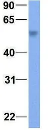 Anti-SLC2A9 antibody, Internal used in Western Blot (WB). GTX46860