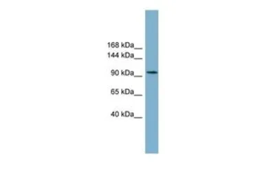 Anti-SLC12A3 antibody, C-term used in Western Blot (WB). GTX46863
