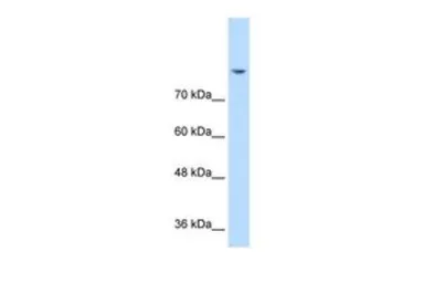 Anti-PSD93 antibody, N-term used in Western Blot (WB). GTX46868