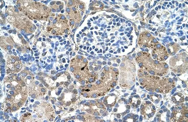 Anti-GLS2 antibody, Internal used in IHC (Paraffin sections) (IHC-P). GTX46870