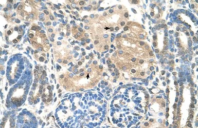 Anti-UBE2E2 antibody, N-term used in IHC (Paraffin sections) (IHC-P). GTX46884