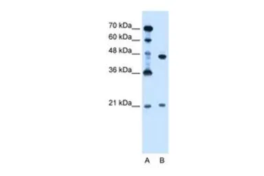 Anti-UBE2E2 antibody, N-term used in Western Blot (WB). GTX46884