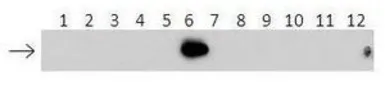 Anti-UBE2E2 antibody, N-term used in Western Blot (WB). GTX46884